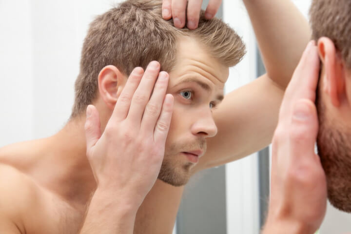 Mann mit Haarausfall | © panthermedia.net /Tomas Anderson
