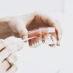 Hände halten ein durchsichtiges Kiefermodell mit Zahnimplantaten und zeigen mit einer zahnärztlichen Sonde auf ein Implantat
